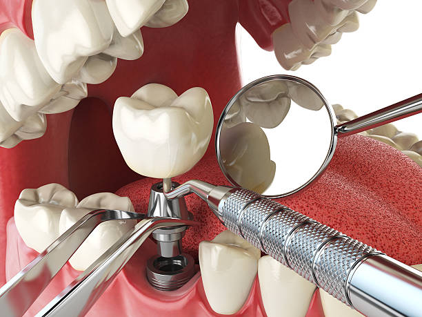 Best Emergency Denture Repair in Myrtletown, CA